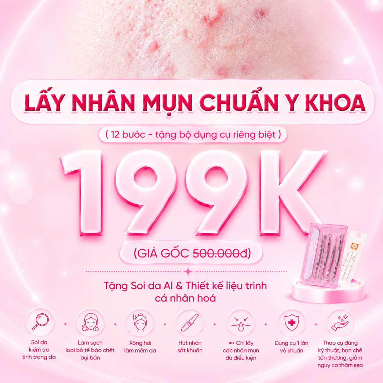 Lấy nhân mụn chuẩn y khoa